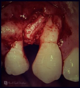 POST-051125_005