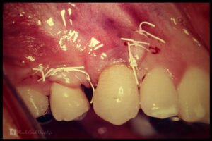 POST-051125_007